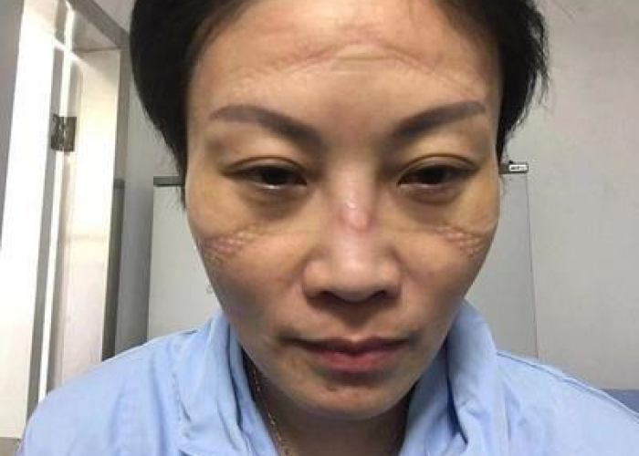 新冠疫情全球一共死了多少人（全球新冠疫情至今死亡人数）