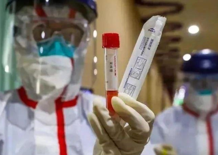 疫情期间我们需要做到什么（疫情期间我们要做到哪些）