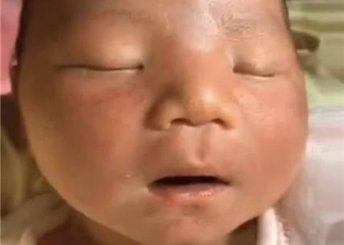 疫情之后抑郁症怎么办（疫情后抑郁症患者暴增）