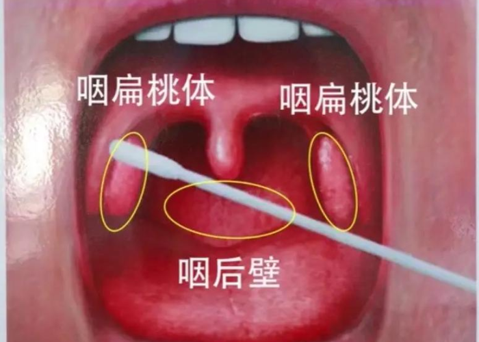 疫情期间应该做的（疫情期间做的囗腔拭子采样录入DNA数据库）