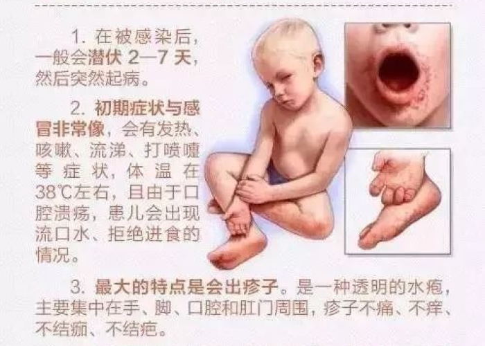 疫情的后遗症呕吐反胃（疫情期间呕吐怎么处理）