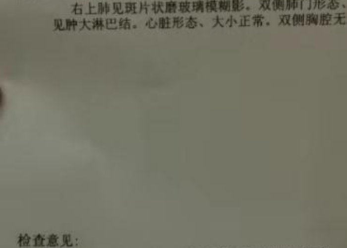 新冠疫情武汉死了多少人（这次新冠肺炎武汉死了多少人?）