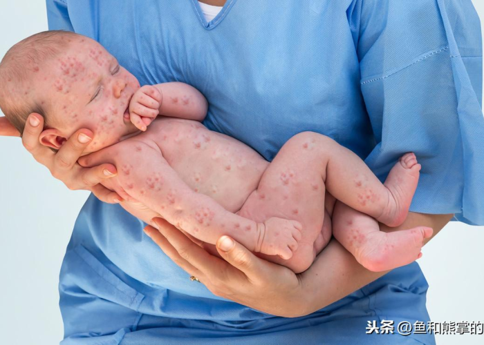 疫情谁带来的（疫情是由谁引发的）