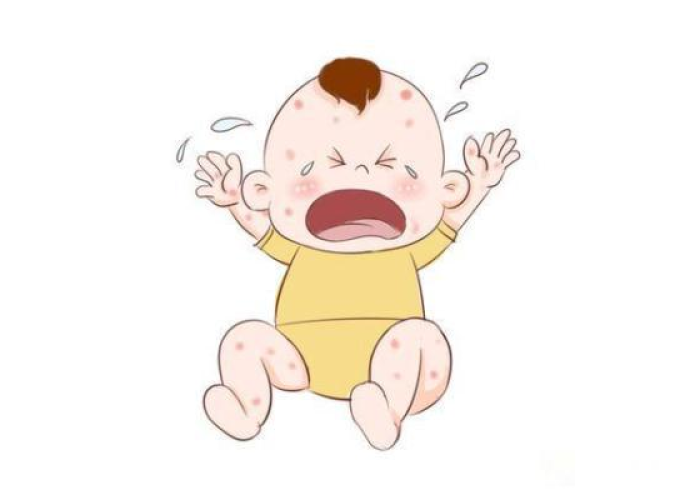 疫情起疹子什么样的（疫情红疹）