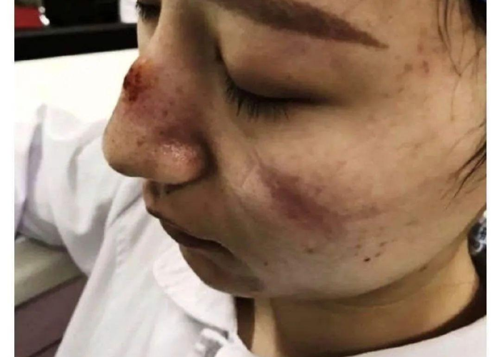 疫情期间戴什么口罩好（疫情期间戴什么口罩最安全）